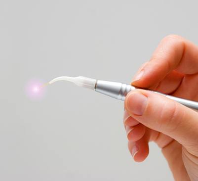 Hand holding a laser dentistry hand tool
