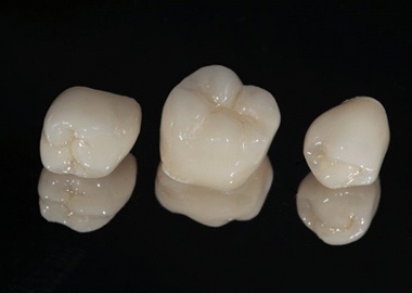 three dental crowns against black background 