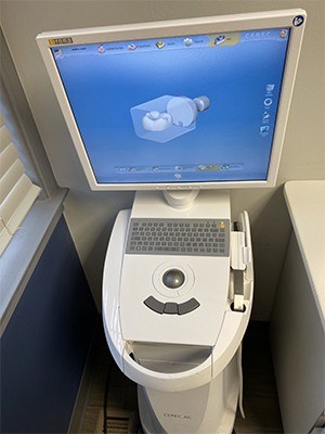 CEREC digital impressions on chairside computer monitor