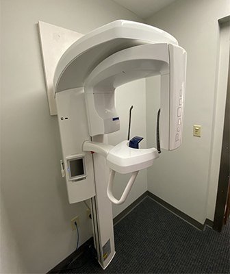 3D CT conebeam dental x-ray scanner