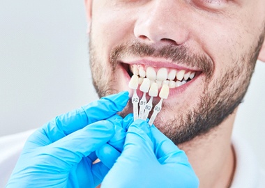 Man at teeth whitening consultation