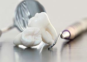 Close-up of two extracted wisdom teeth in Granby, CT