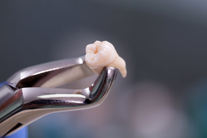 Close-up of a tooth extraction