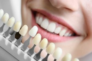 Patient at dentist’s office receiving porcelain veneers.