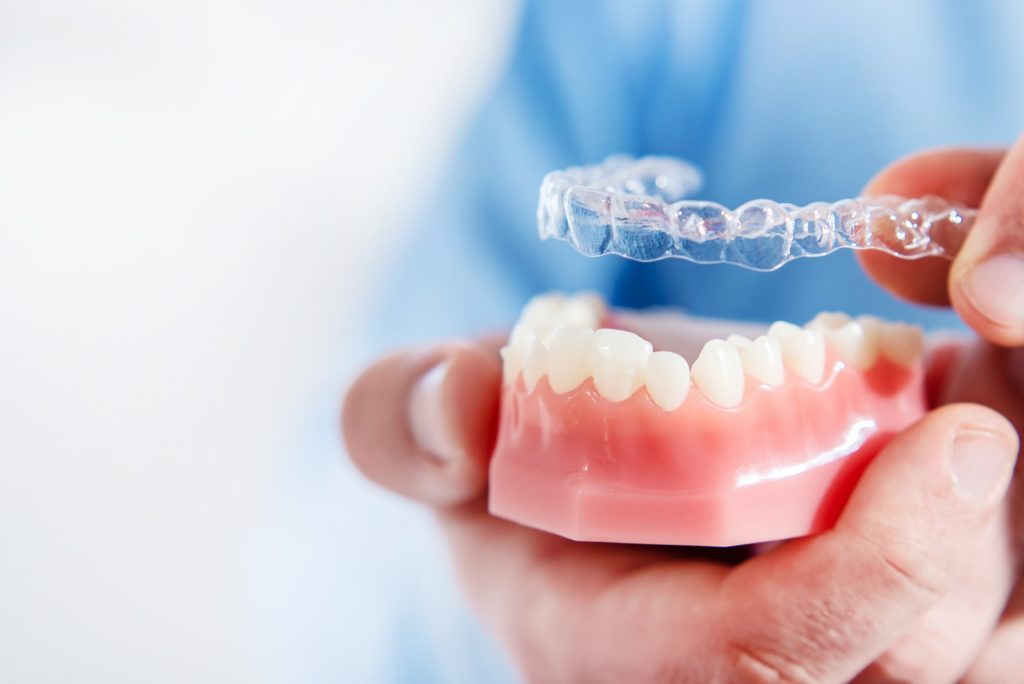 Dentist placing clear aligners on model of teeth