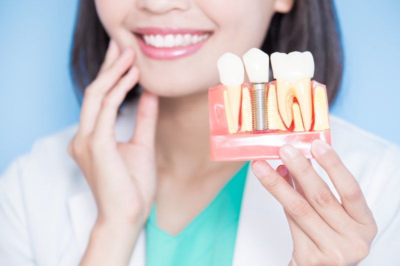 A dentist holding a dental implant model
